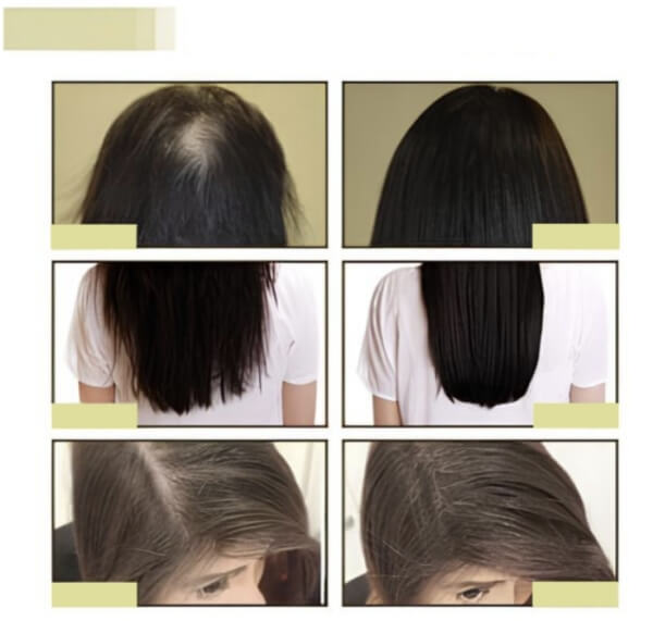 EELHOE Hair Growth Oil – co to jest i jak działa